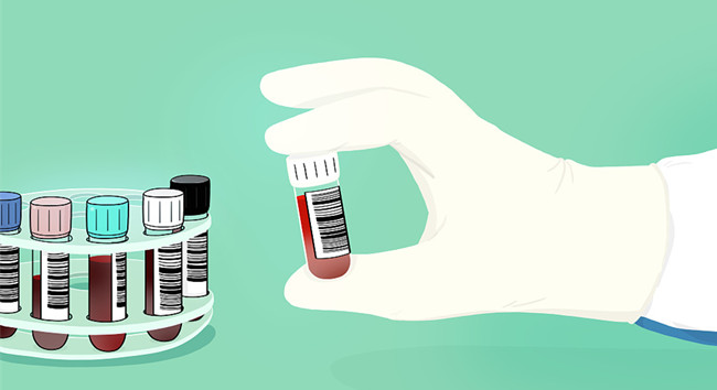 進口胎牛血清關需要什么資質？